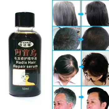 Natūralus organinis veiksminga Kinų žolinis vaistas pilka plaukų gydymas baltų plaukų terapija jokio šalutinio poveikio 50ml