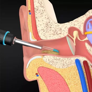 XIAOMI MIJIA Pažangi vaizdo ausies skinti lazdele 300W didelio tikslumo endoskopą su 350mAH magnetinio apmokestinimo bazės